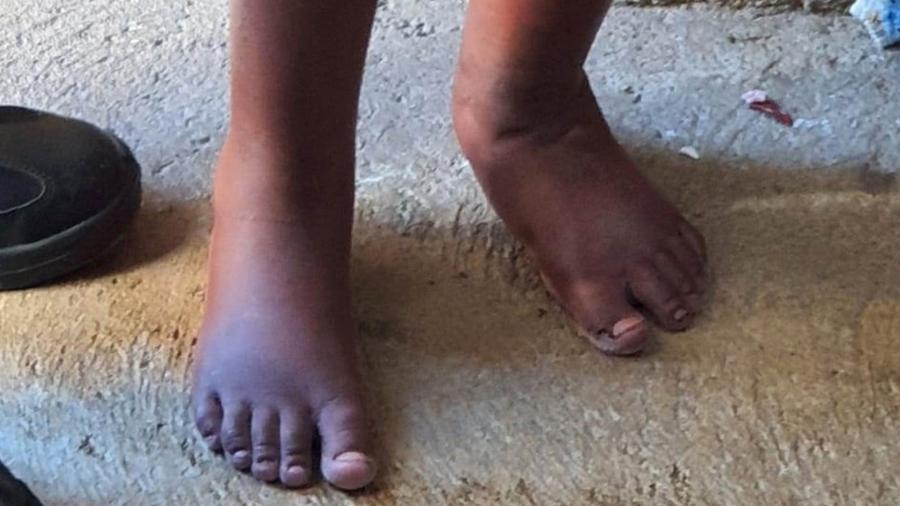 Investigação aponta que menino ficou em barril por pegar comida que não devia - News Rondônia