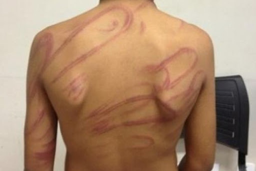 Adolescente é agredido pelo tio após revelar que é gay - News Rondônia
