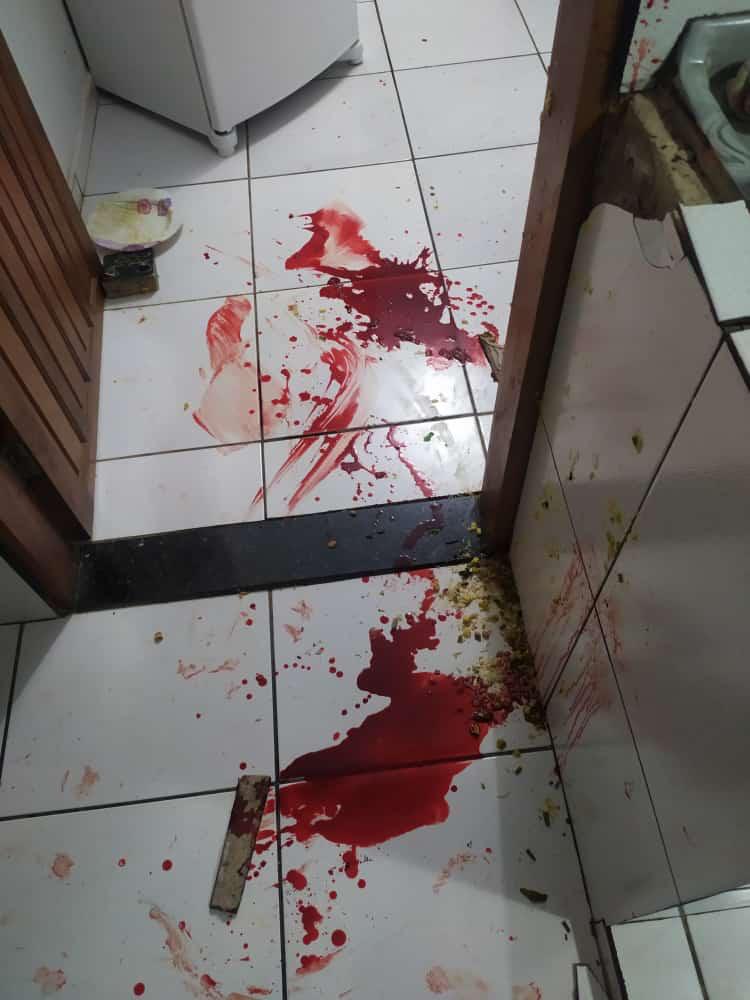 FOTOS - Homem sofre atentado à tiros em Ji-Paraná e acaba sendo baleado na cabeça - News Rondônia