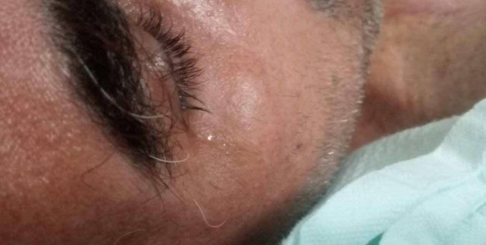 Internado há seis meses e implorando por cirurgia, morador de Colorado do Oeste está ficando com o corpo 'em carne viva' - News Rondônia