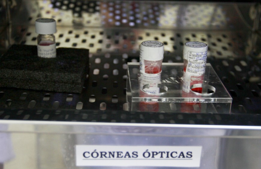 SERVIÇO - Banco de Olhos do Hospital de Base retoma a captação de córneas a partir de doadores falecidos - News Rondônia