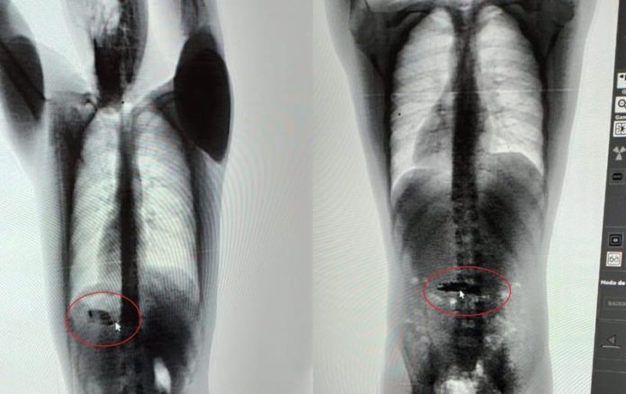 PRESOS ENGOLEM CELULARES E SCANNER CORPORAL DETECTA APARELHOS NO ESTÔMAGO - News Rondônia