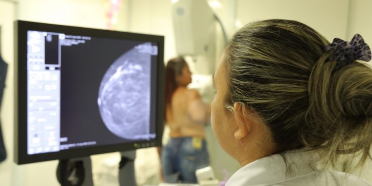 Carreta de mamografia do hospital de amor, estará em Jaru em julho - News Rondônia