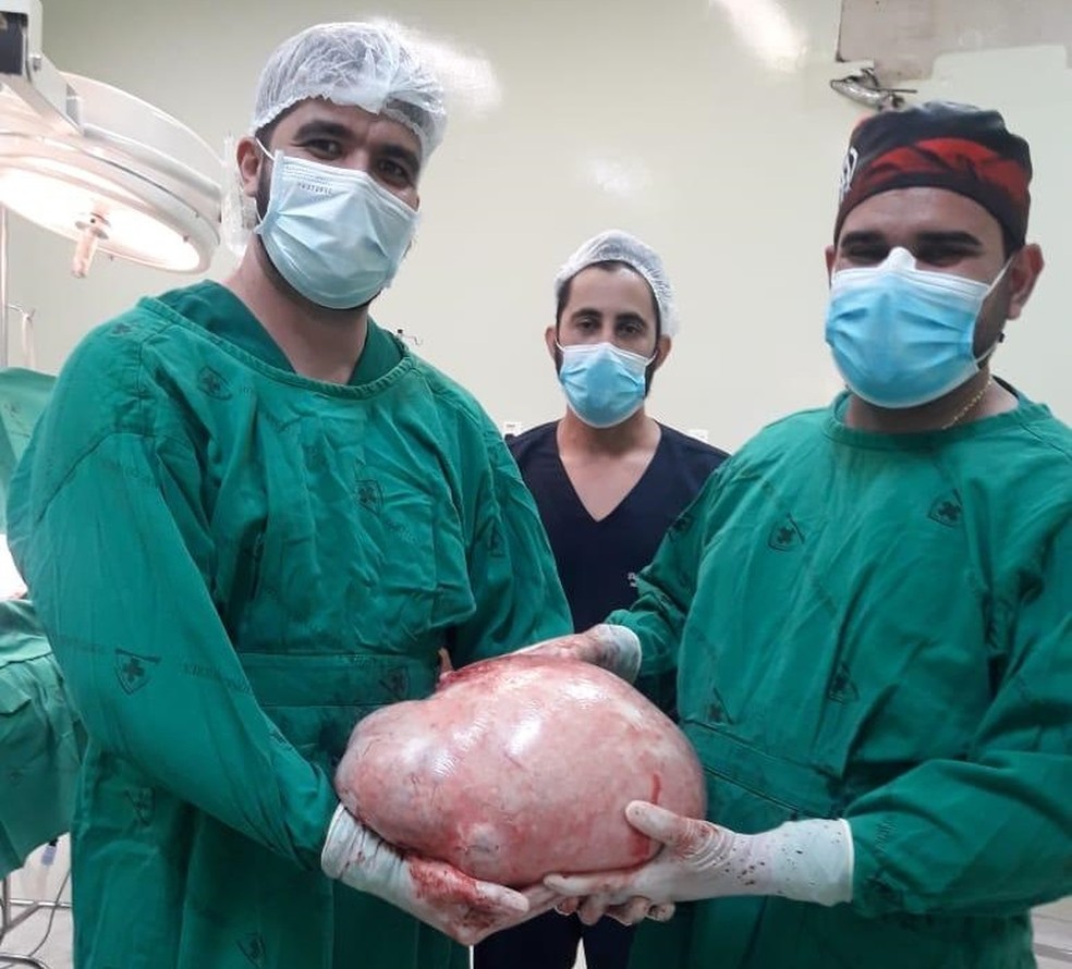 Cruzeiro do Sul: Tumor de quase 20 quilos é retirado do ovário de paciente - News Rondônia