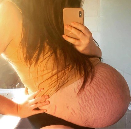 Mãe achava que teria gêmeos, mas dá à luz bebê de quase 6 kg - News Rondônia