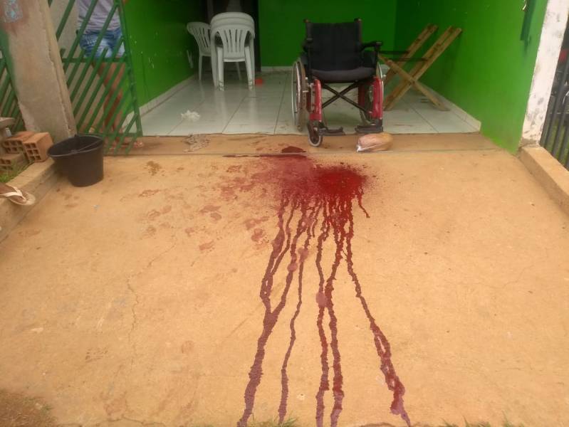 Cadeirante de 32 anos é baleado em tentativa de homicídio - News Rondônia
