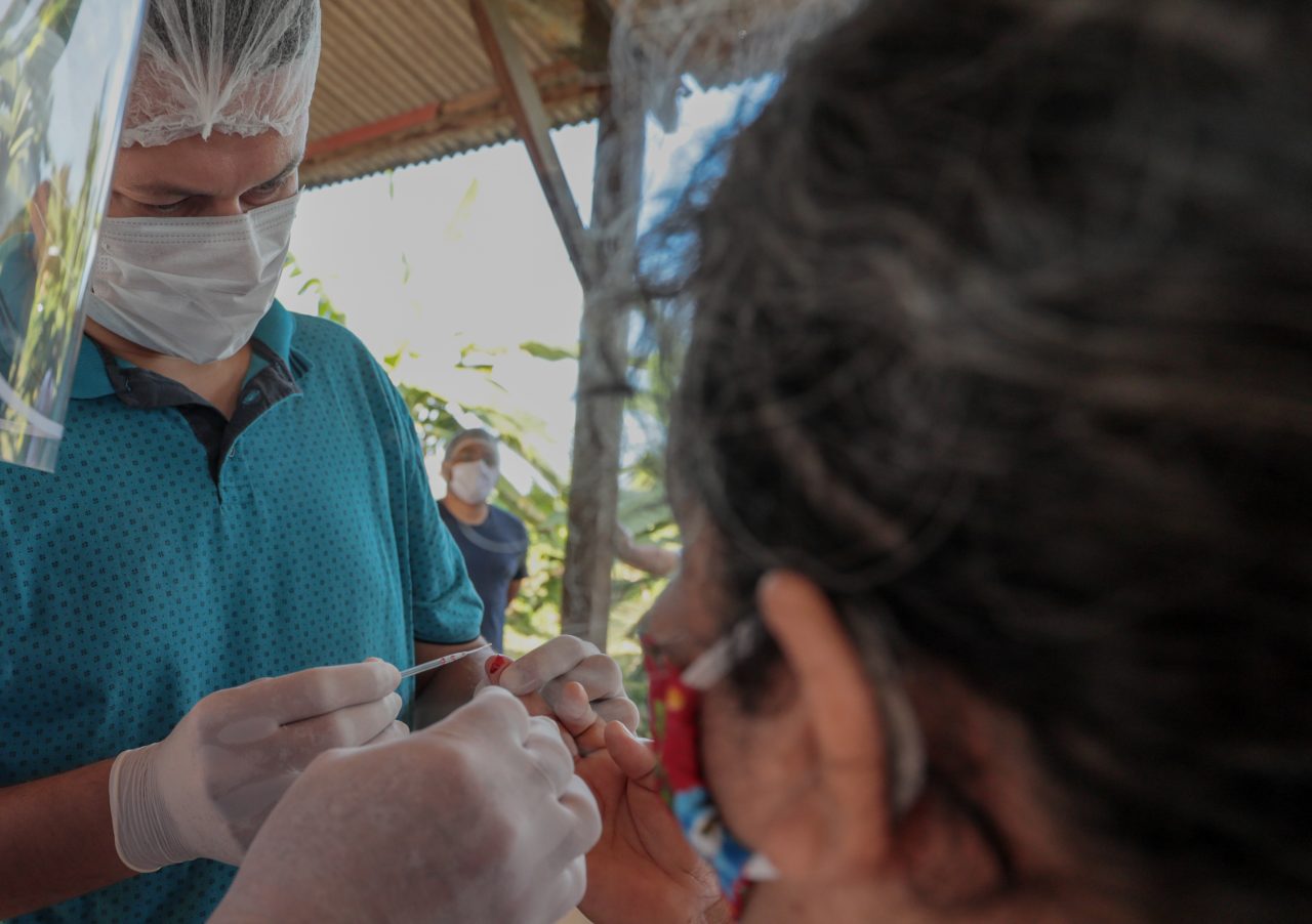 Profissionais de saúde orientam o momento mais adequado para fazer o teste da Covid-19 - News Rondônia