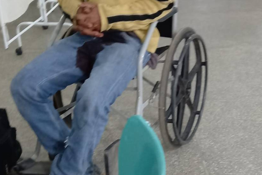 Vilhenense de 37 anos sobrevive após atropelar e matar anta com moto na BR 364, mas sofre ferimento no pênis - News Rondônia