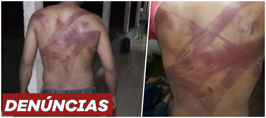 Trabalhadores são torturados e expulsos por grupo de invasores, em fazenda de Rondônia - Por Anderson Nascimento - News Rondônia