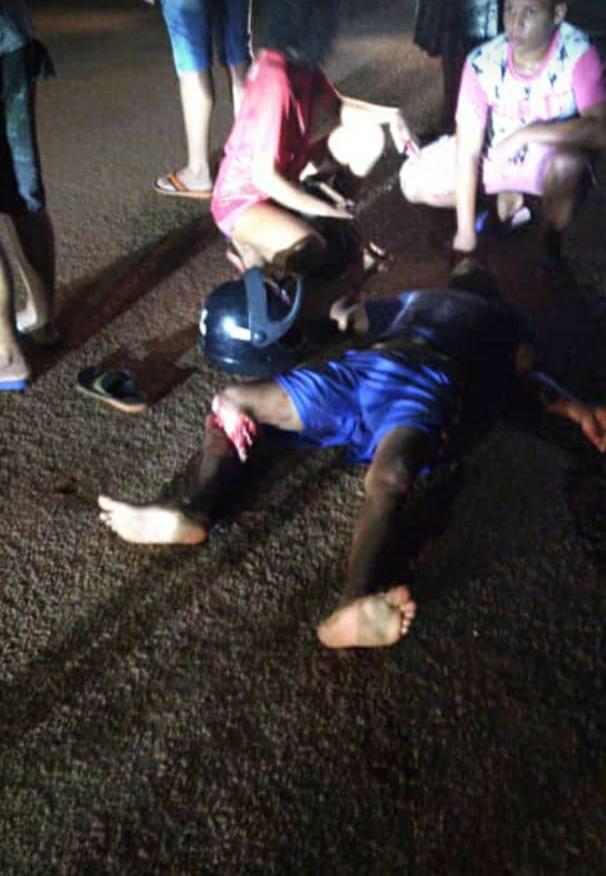Motociclista sofre fratura exposta ao ser atingido por carro conduzido por policial militar aposentado embriagado - News Rondônia