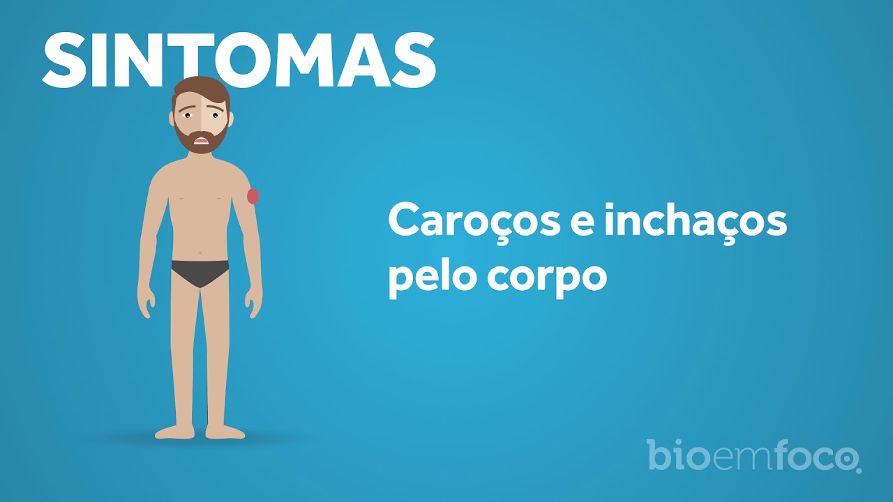 BRASIL É O SEGUNDO PAÍS COM MAIS OCORRÊNCIAS RECENTES DE HANSENÍASE - News Rondônia