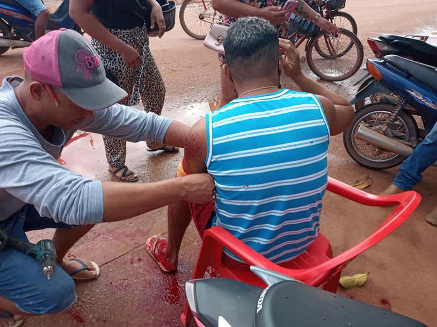 IMAGENS FORTES - Homem não entrega motocicleta e acaba sendo baleado à queima-roupa - News Rondônia