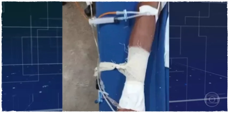 COVID-19: pacientes intubados são amarrados as camas; pratica é feita em hospitais de Rondônia; revela reportagem da Folha - News Rondônia