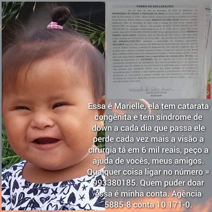 Criança com síndrome de down está com catarata congênita e família pede doações para custear cirurgia - News Rondônia