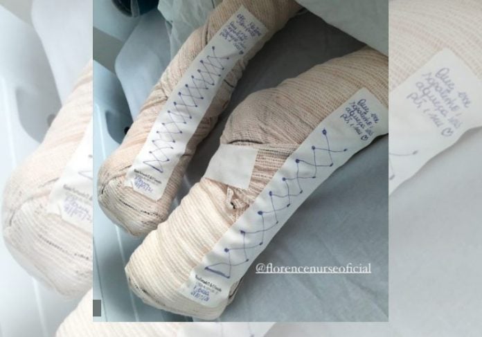 Enfermeira emociona com sapatinhos improvisados para aquecer pés de paciente - News Rondônia