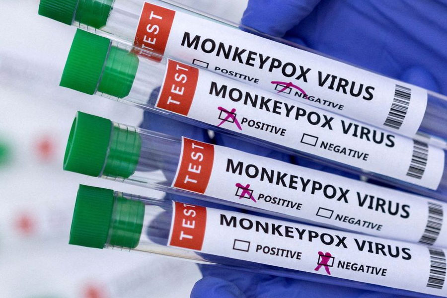Casos de varíola dos macacos chegam a 76 em todo o país - News Rondônia